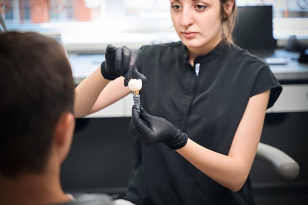 Dental Implant Crown Placement FAQs