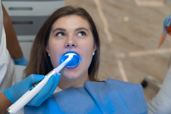 How Does In Office Professional Teeth Whitening Work?